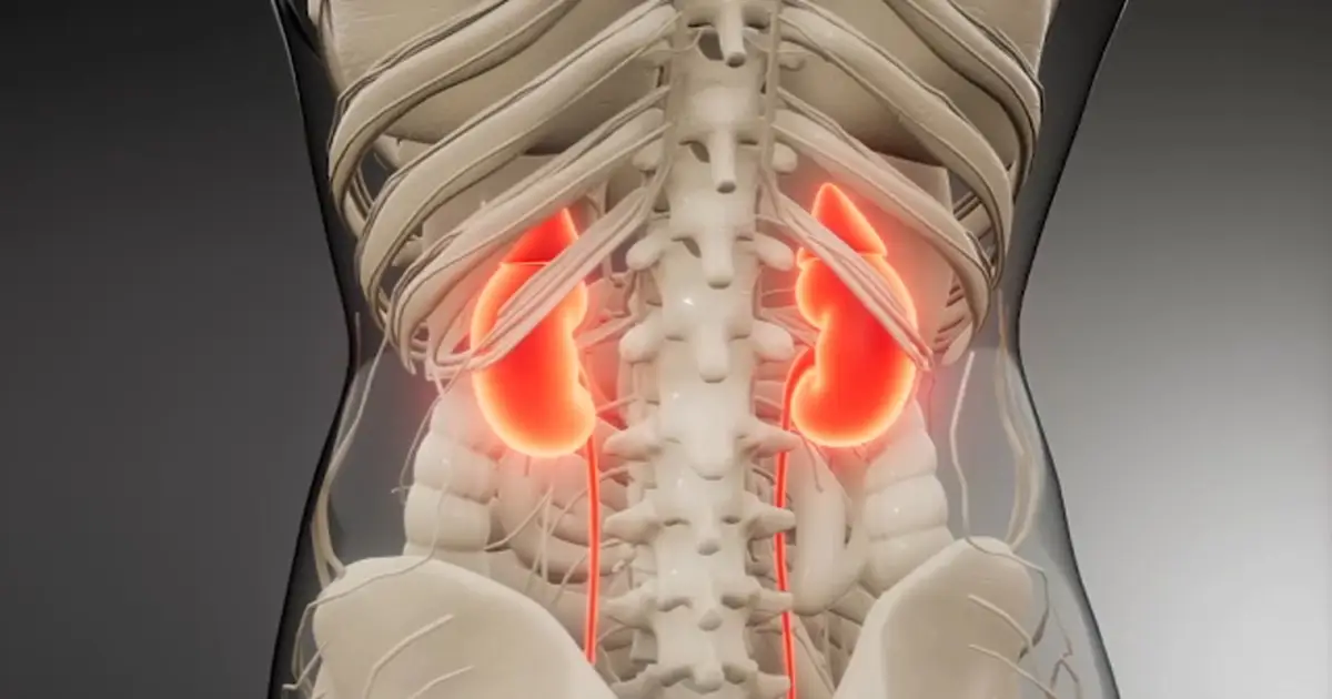 UCI Health launches promising clinical trial using CAR T - cell therapy to treat lupus