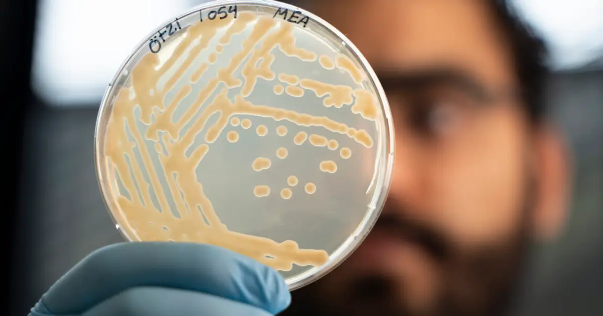 Some ancient microbes frozen with Ötzi the Iceman are still growing