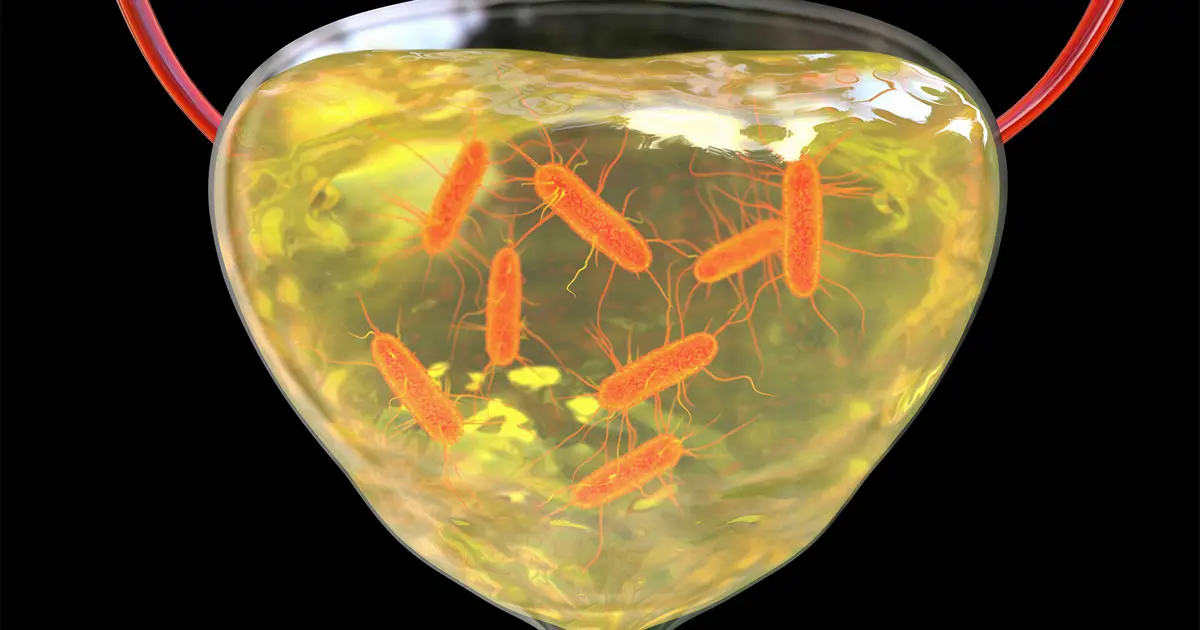 Promising E. Coli Vaccine Fizzles in Late-Stage Trial