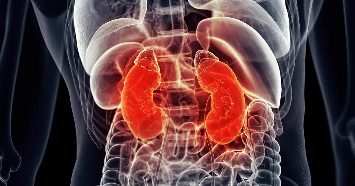 Combination Cuts Kidney Injury Risk Following Septic Shock Procedure