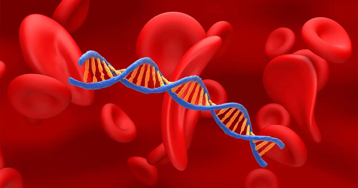 Improving Survival for Adults With Sickle Cell Disease