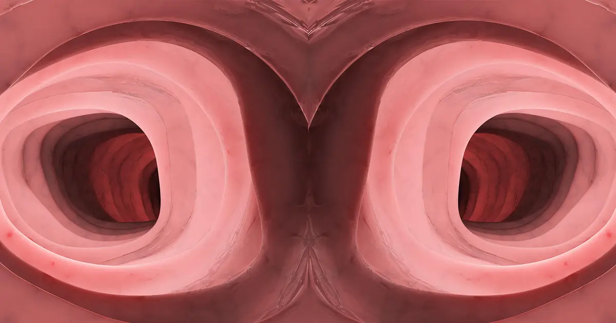 'Constipation' Lands Patient in Surgery for Unusual Anatomy