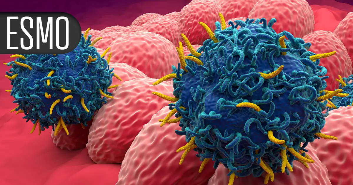 Tovecimig-Based Doublet Boosts Response and PFS in Advanced Biliary Tract Cancer