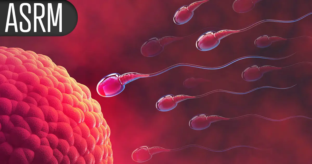 Couples Achieved Live Births Faster With IVF First