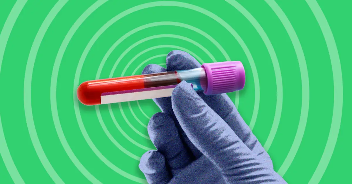 A new blood test can help detect colon cancer, but it’s not as good as the test you hate to take