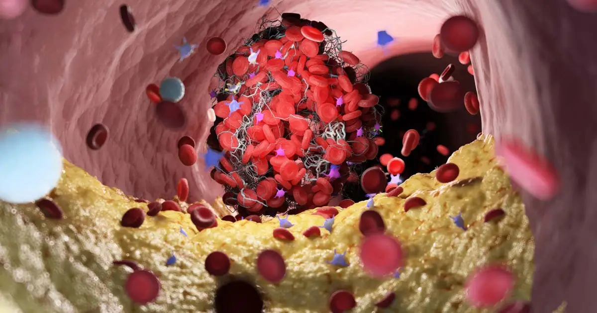 Simple treatment tweak drastically reduces blood loss from severe cuts