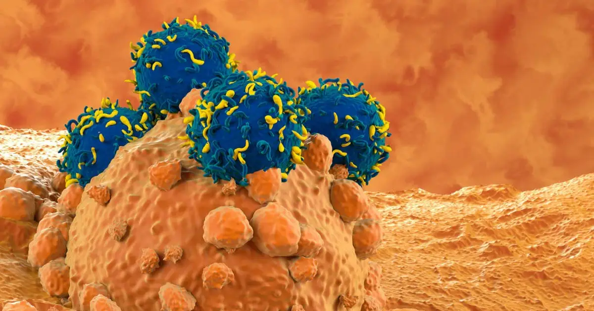 CAR T-cell therapy bolstered by stiffening up cancer cells first