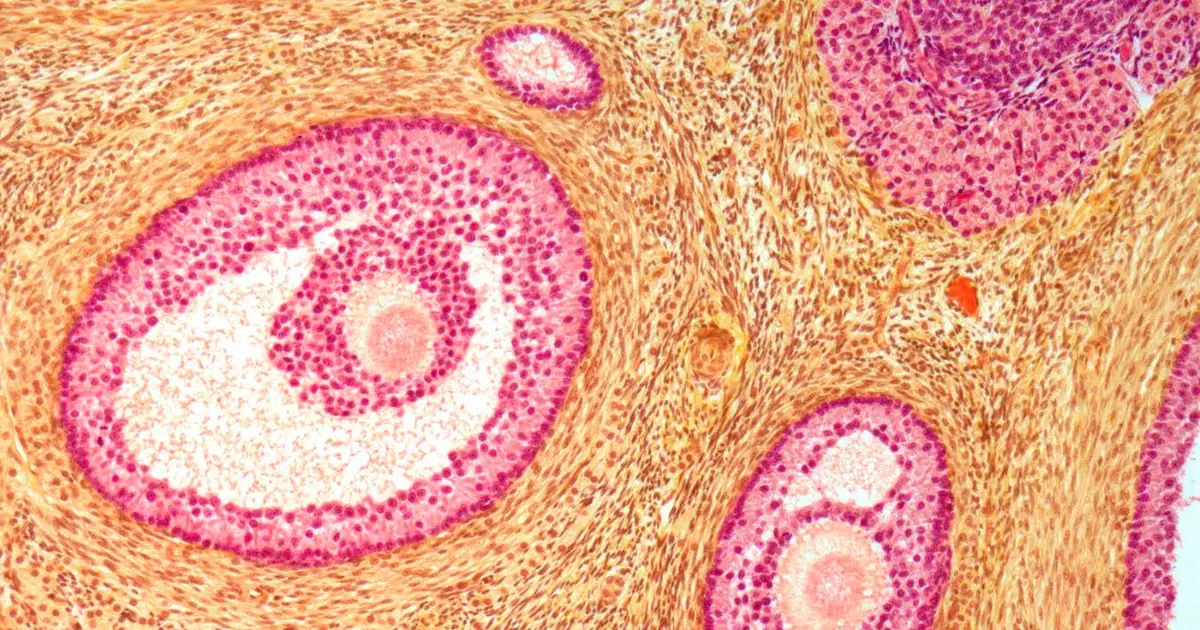 Our fertility window could be extended by making ovaries softer