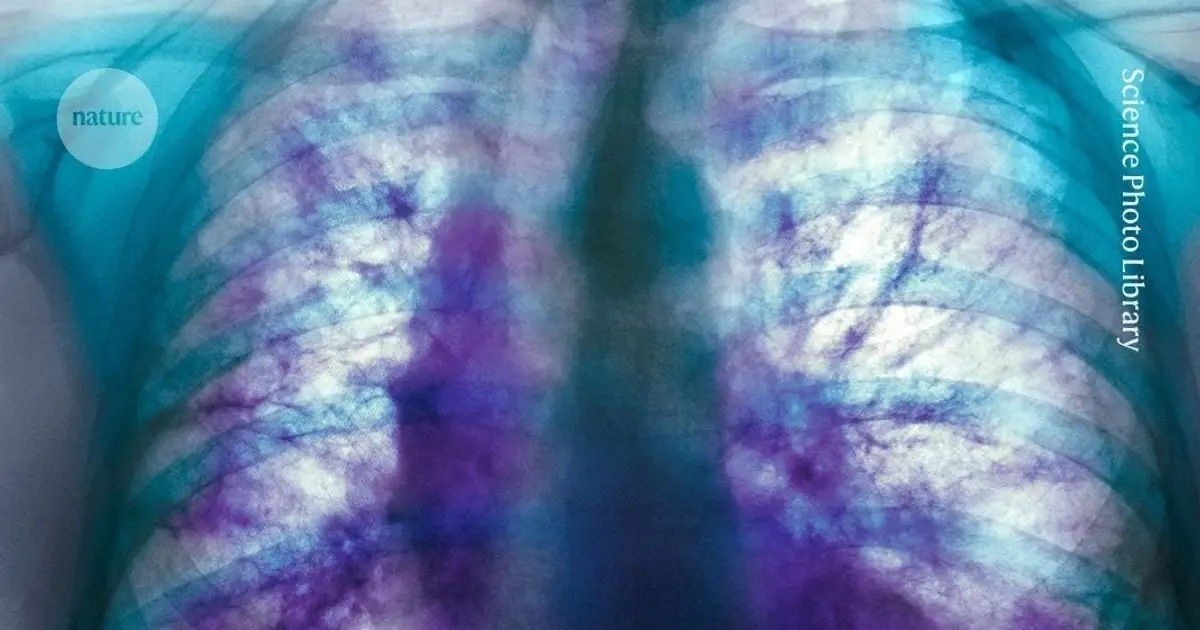 This mysterious lung disease affects millions of people – a drug tested in mice shows promise