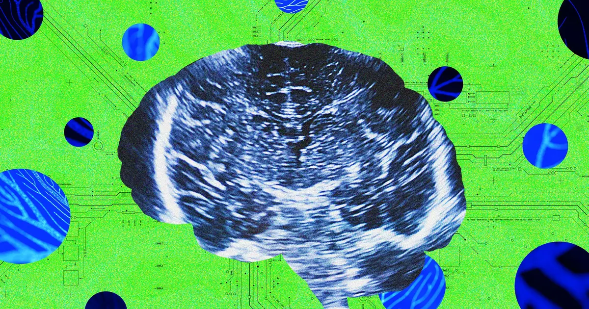 A New Neurotech Startup Launches to Rival Sam Altman’s Merge Labs