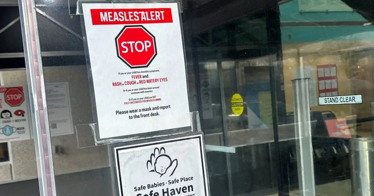 South Carolina measles vaccinations jump in January after major outbreak