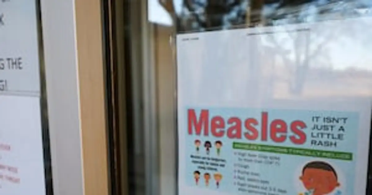 Measles cases confirmed in Mecklenburg County , linked to South Carolina outbreak