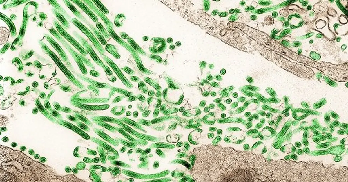 DR Congo's Ebola outbreak tops 3,000 cases