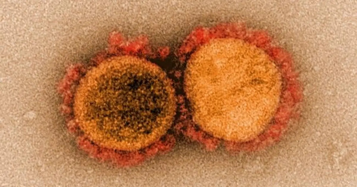 A lesser-known SARS-CoV-2 protein may offer clues to long COVID symptoms