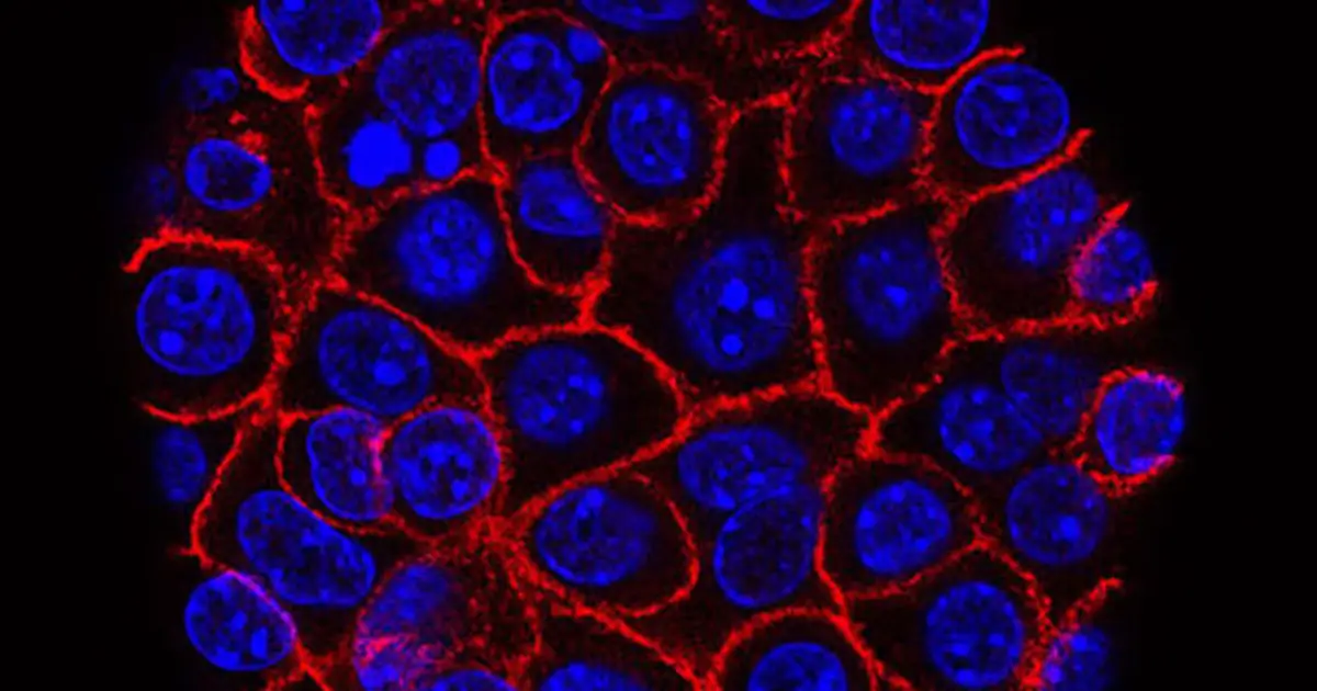 Continuously evolving cells help pancreatic cancer evade treatment and spread