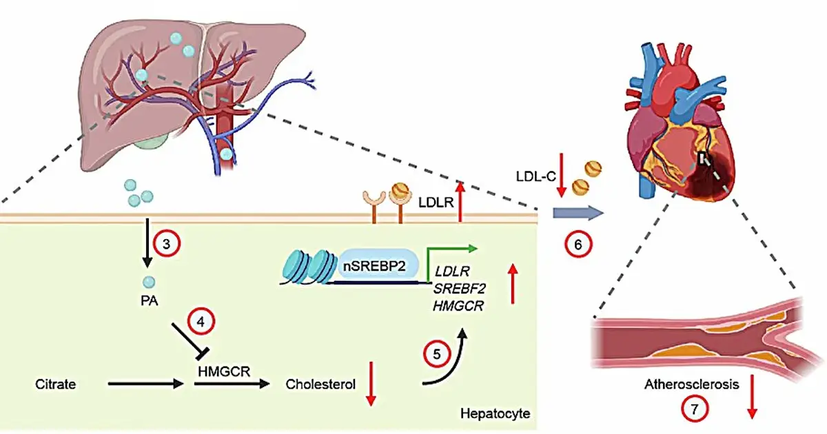 A gut microbe makes a fatty acid that cuts artery plaque in half in mice