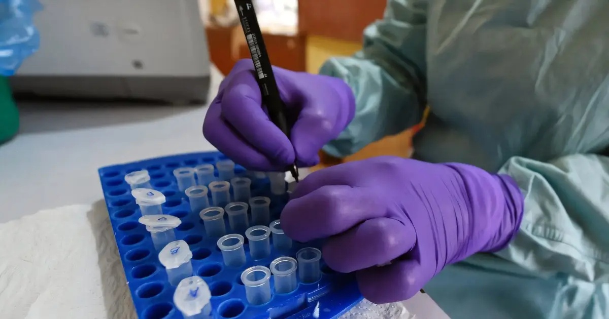 Nigeria Ebola case matches DR Congo strain