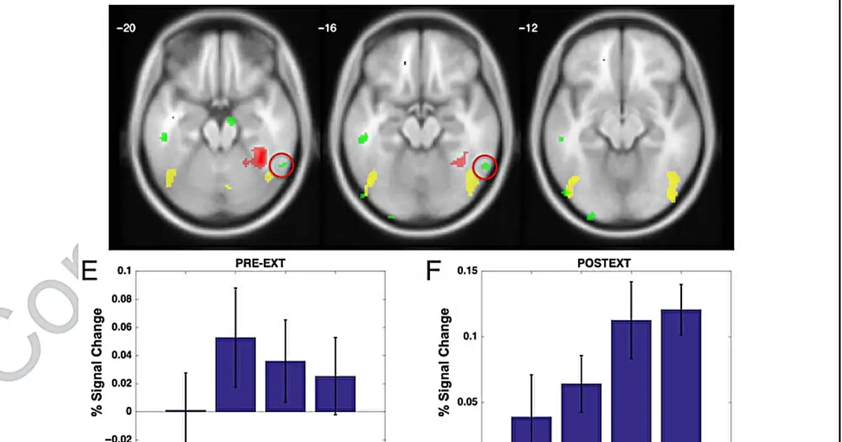A skill becomes automatic as the brain rewires itself to bypass its own bottleneck, new study suggests