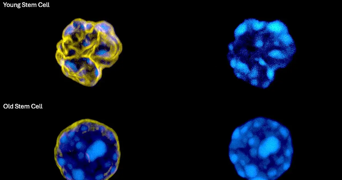 AI detects signs of aging in blood stem cells from nuclear images