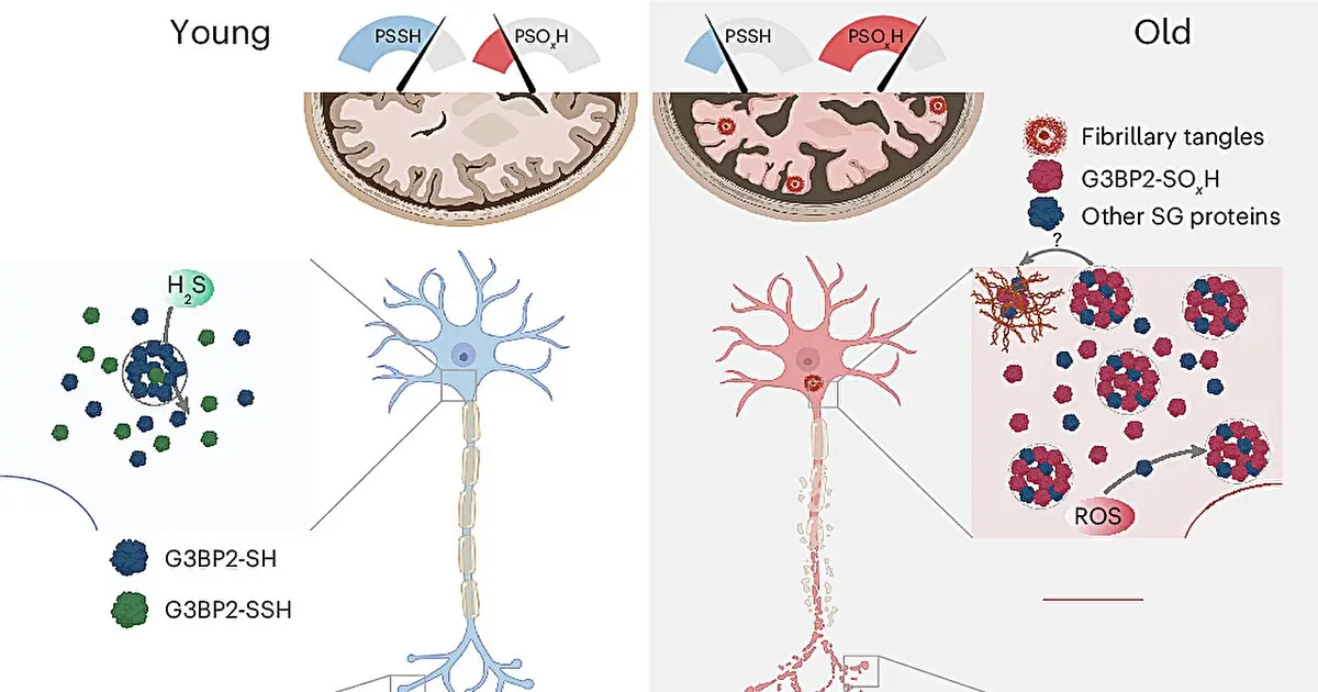 Aging oxidation drives brain proteins into harmful condensates, study finds