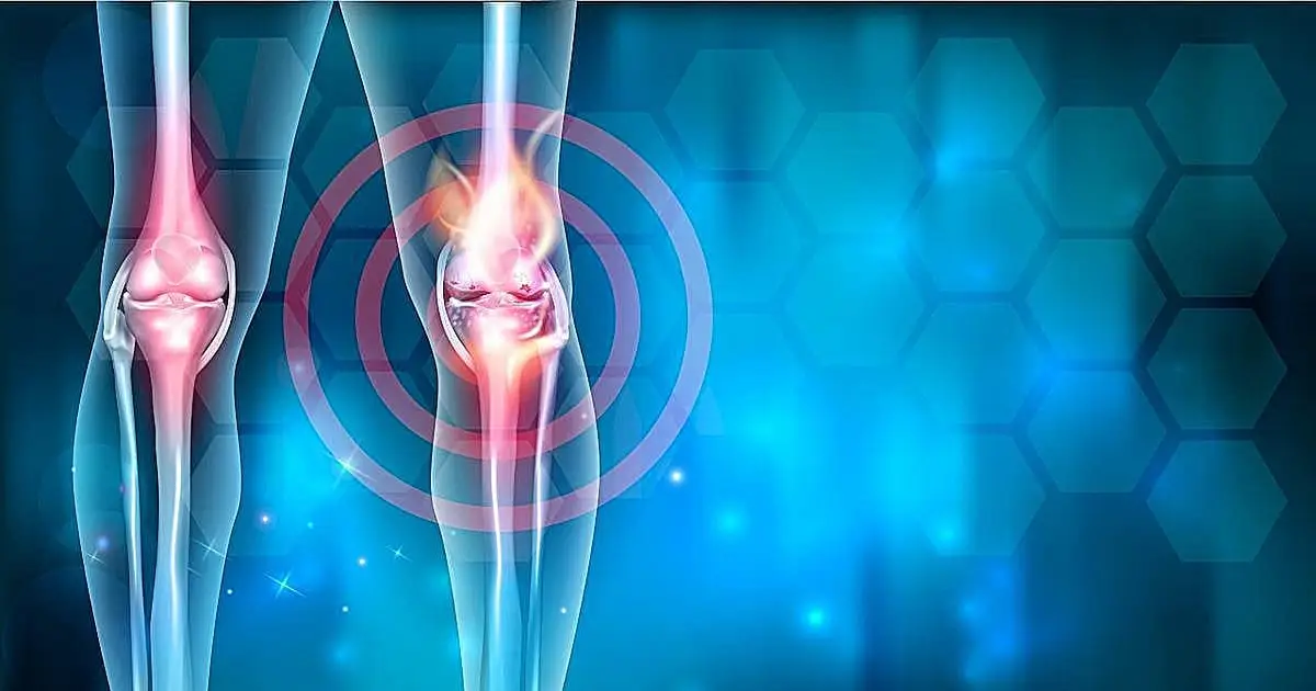 ASTRO: Low-dose radiotherapy shows potential in early knee osteoarthritis