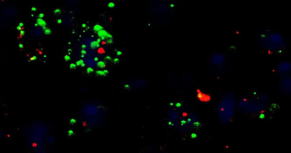 Brain signaling mechanism may explain clozapine weight gain