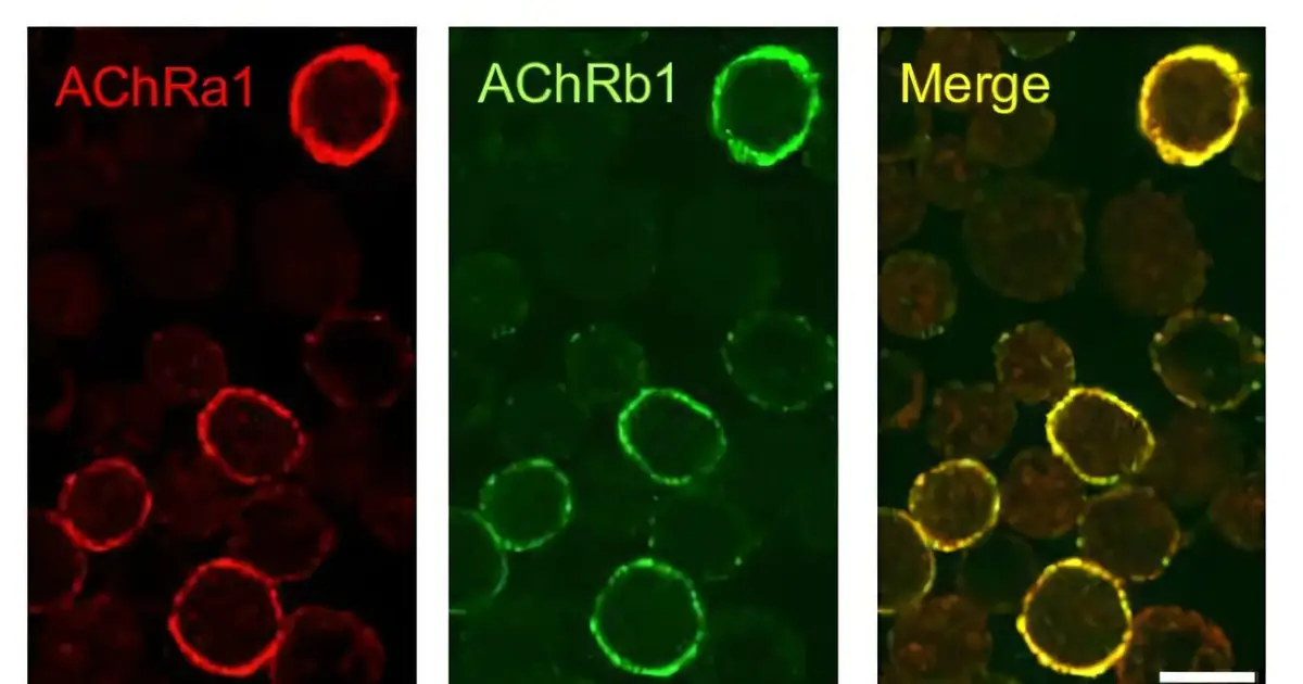 CAAR T-cell therapy offers a more targeted route for neurological autoimmune diseases