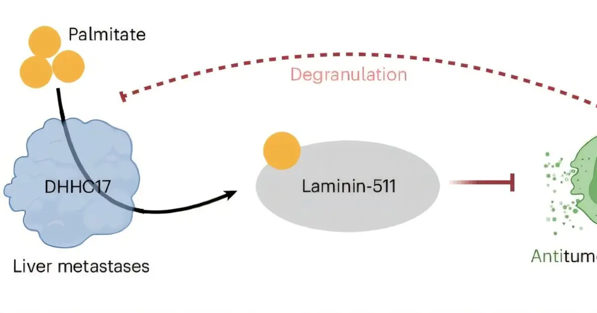 Cancer cells hijack a fatty acid to escape immune attack in liver metastases