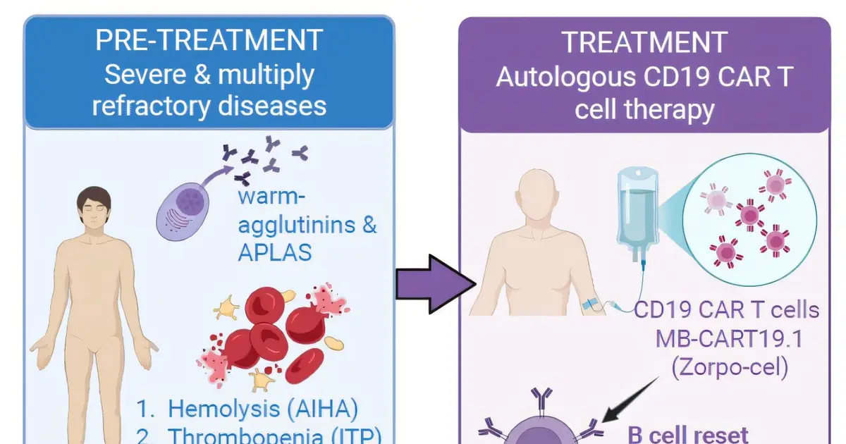 CAR-T therapy drives remission in patient with three autoimmune diseases