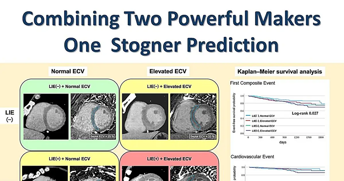 This routine heart scan sees the danger coming long before symptoms strike