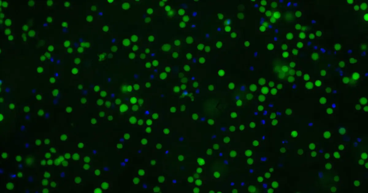 Cell-preservation technique could make CAR-T cell therapy more accessible