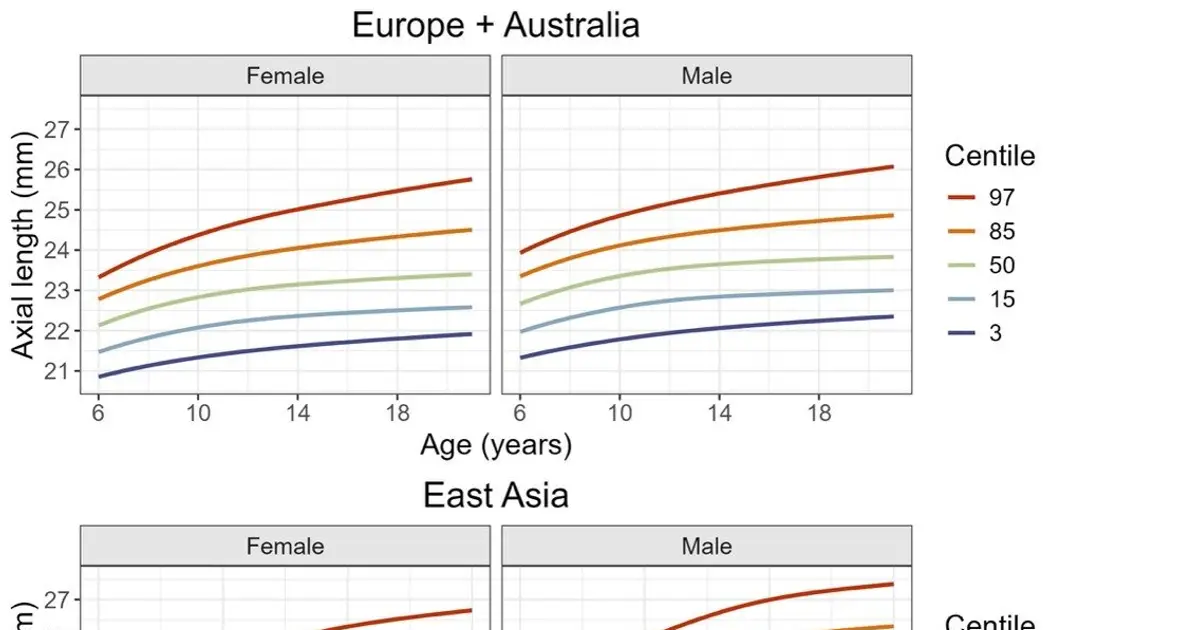 Charting children's eyes to head off global myopia epidemic