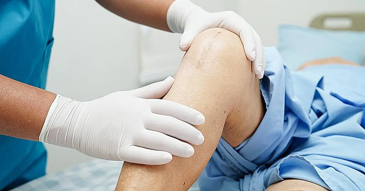 Crohn disease linked to increased risk for periprosthetic joint infection