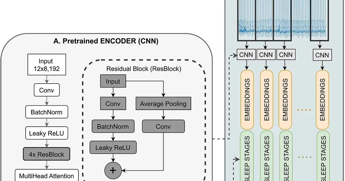 Deep learning model using ECGs during sleep studies can predict cardiovascular outcomes