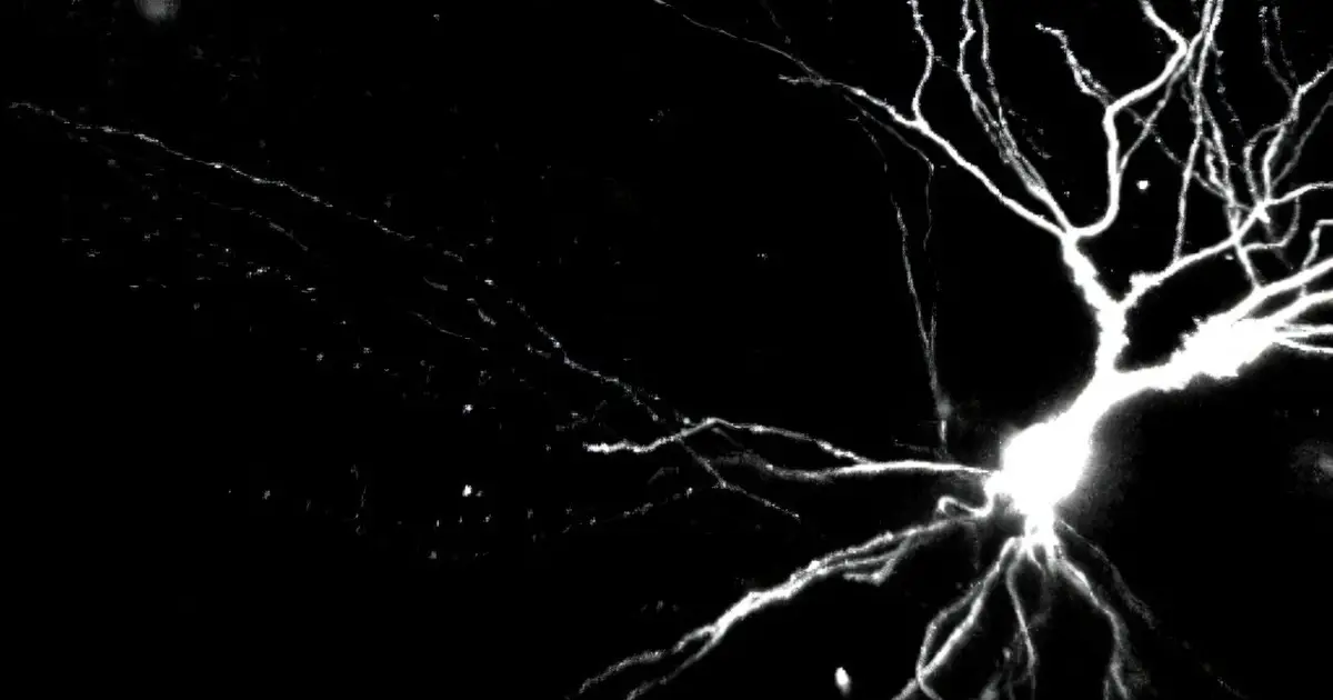 Dendrites may be key to learning and memory, study suggests