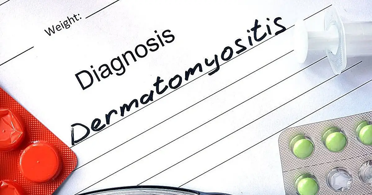 FDA approves Lisraya for dermatomyositis in adults