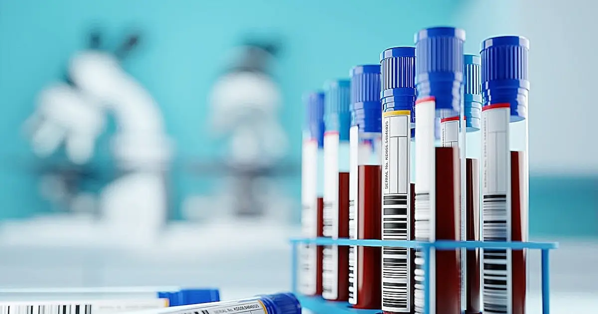 FDA authorizes first standalone robotic device to draw blood