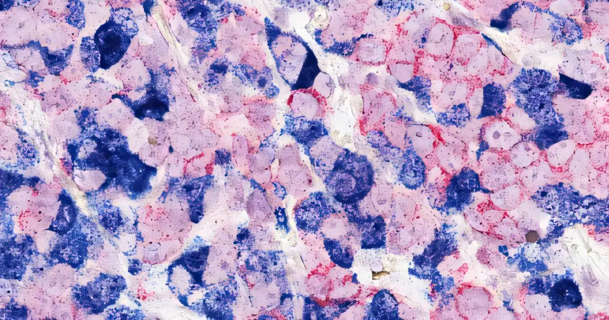 Genome editing in rats enables more accurate estrogen receptor-positive breast cancer models