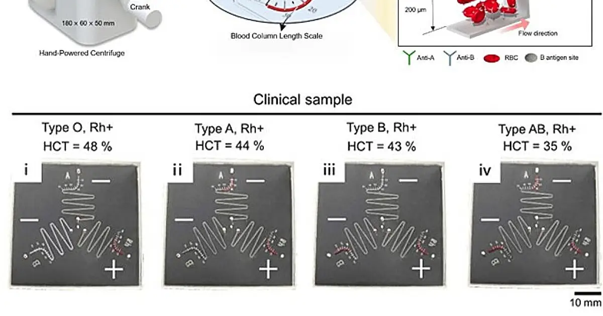 Hand-cranked device tells blood type and red cell levels in 1 minute