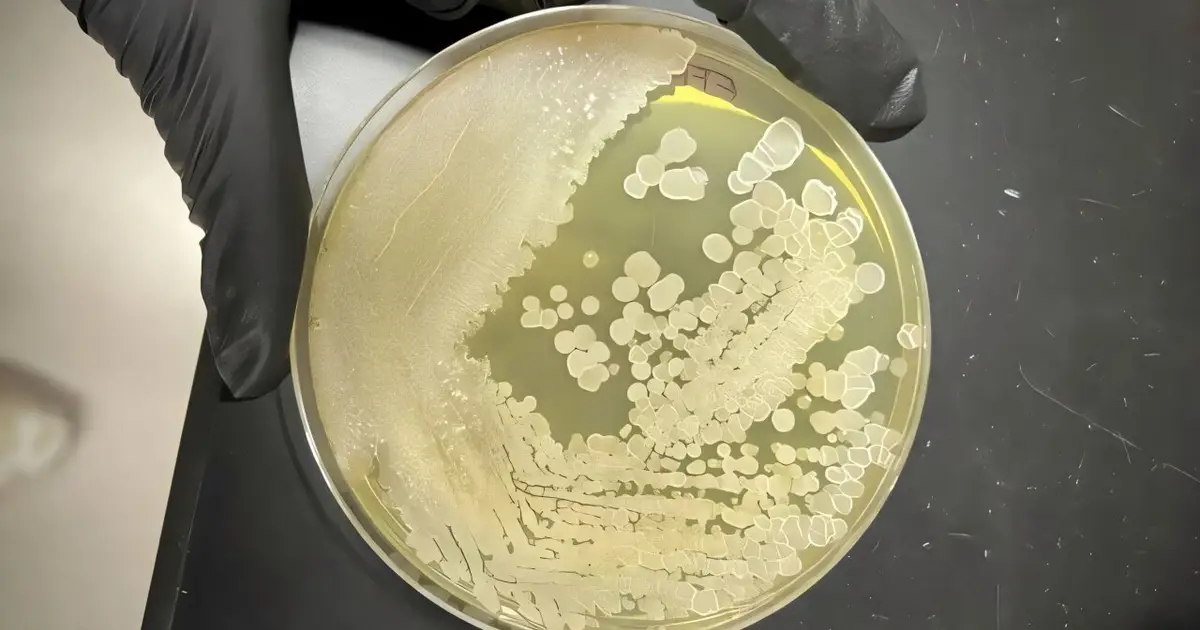 Helpful microbes could battle pathogens in our hospitals and schools—with the help of AI to make it work
