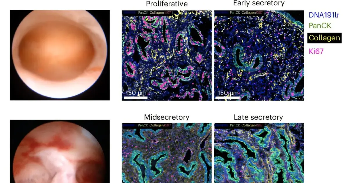Hidden immune cells may hold key to tackling female infertility
