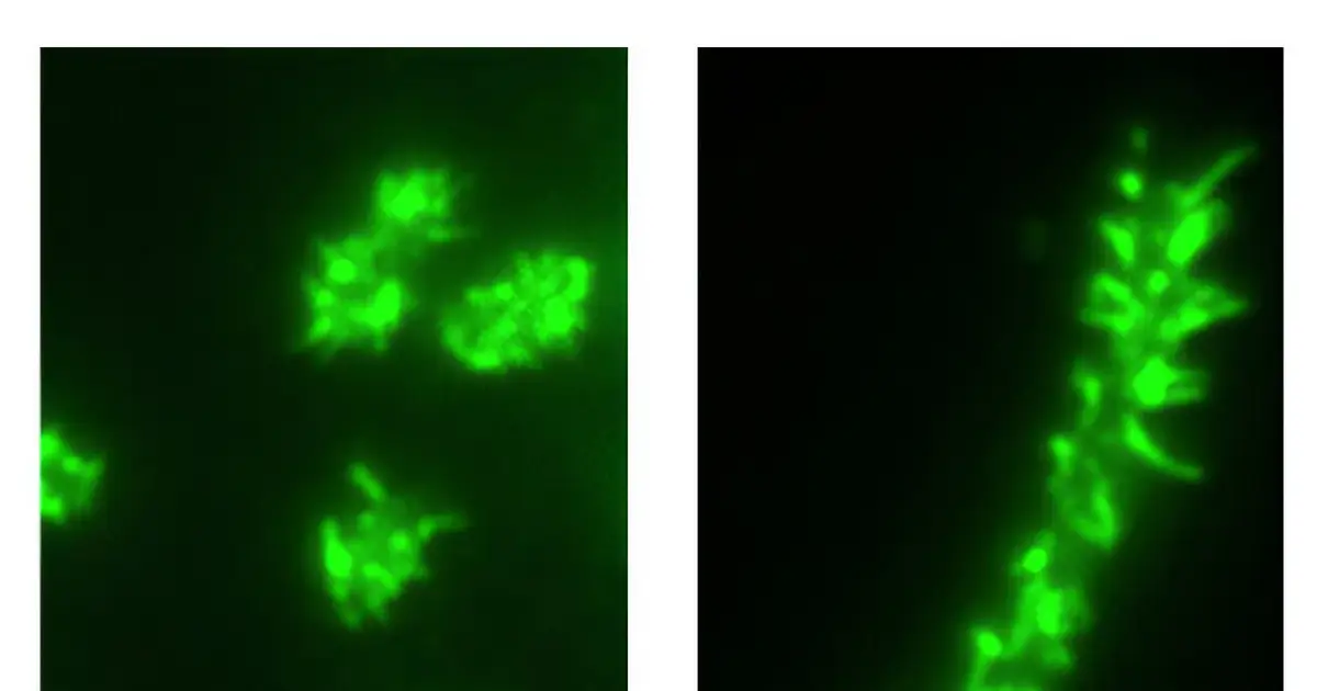 New mechanism reveals how atypical E. coli maintain their ability to infect