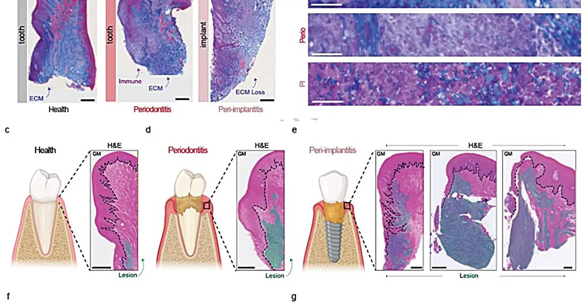 How studying oral inflammatory diseases can help researchers understand other human diseases