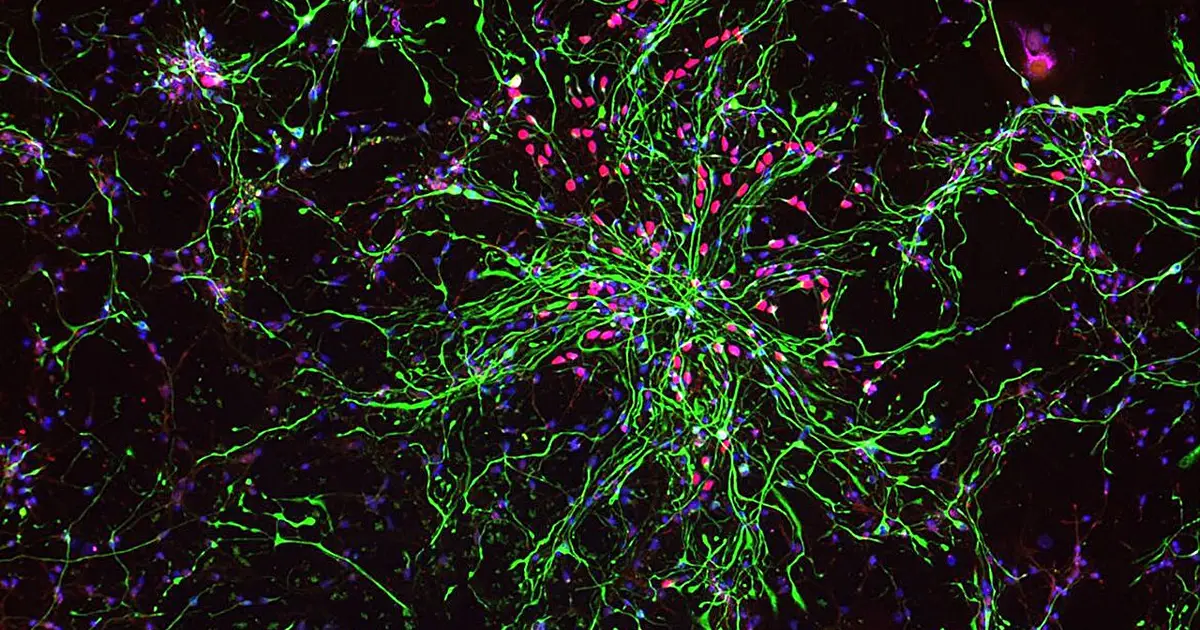 How the developing human brain takes instructions: Two studies reveal what guides its most important stem cells