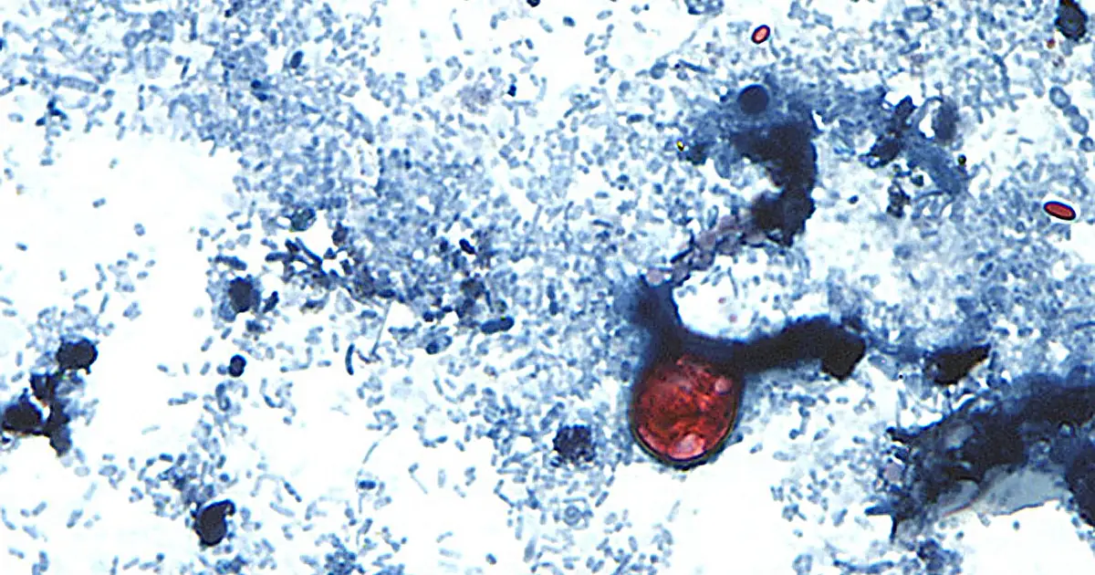How to stay safe and still enjoy produce this summer with the outbreak of diarrhea-causing parasite