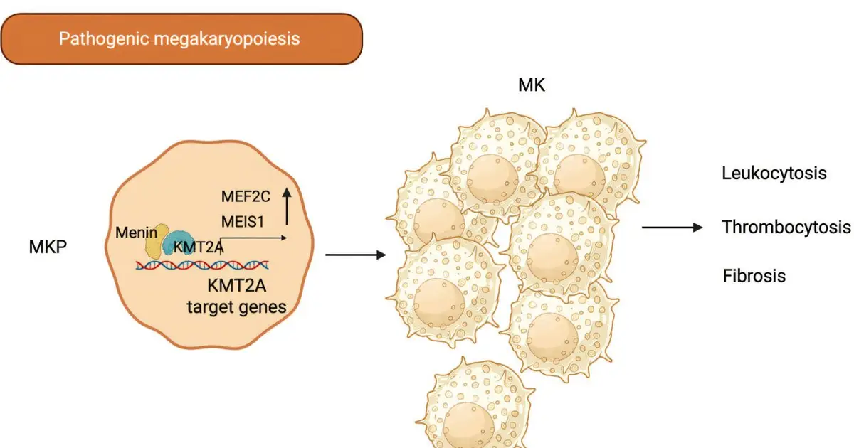 Inhibiting protein to treat myeloproliferative neoplasms shows preclinical promise
