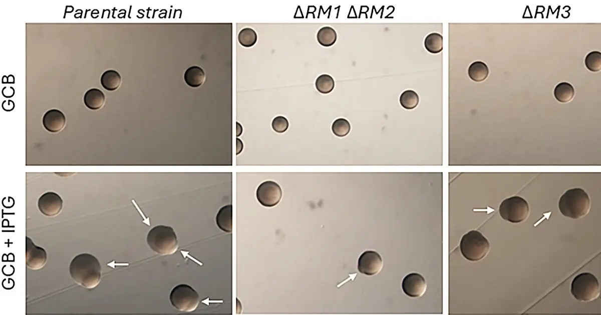 Intricate molecular mechanisms help bacteria evade immune detection