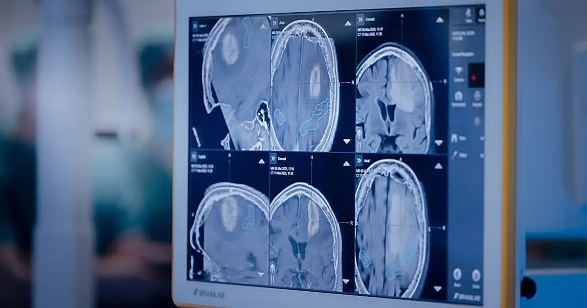 Researchers develop privacy-friendly, secure and sustainable AI techniques for medical imaging
