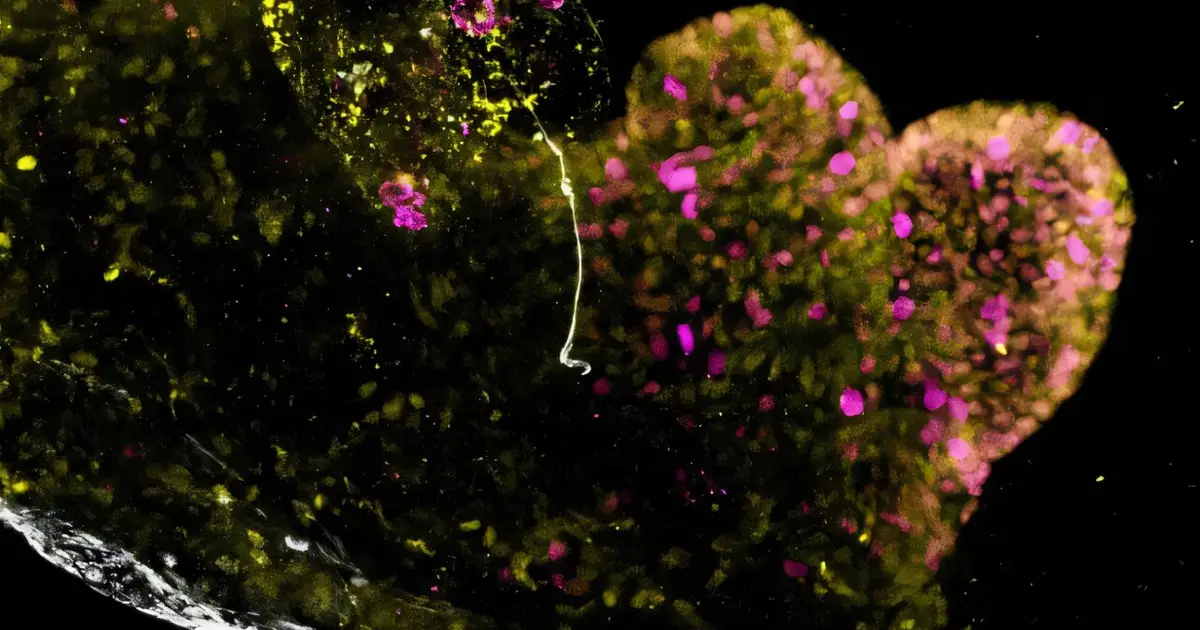 Lab - grown mini - stomachs could boost understanding of rare diseases