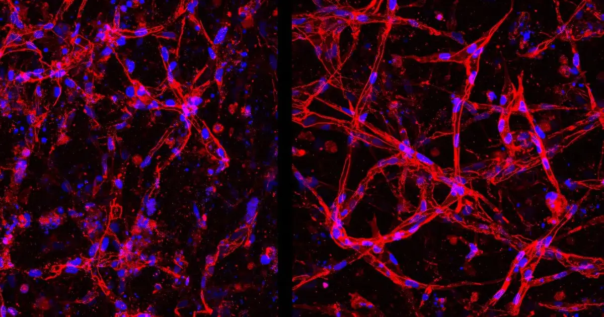 Lab-grown retinal cells show promise for new eye therapies